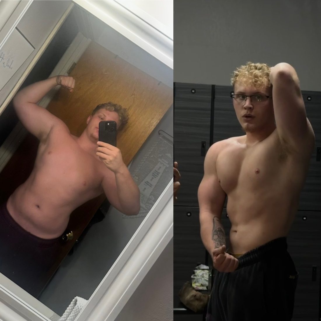 Patient before-and-after — front double-biceps pose
