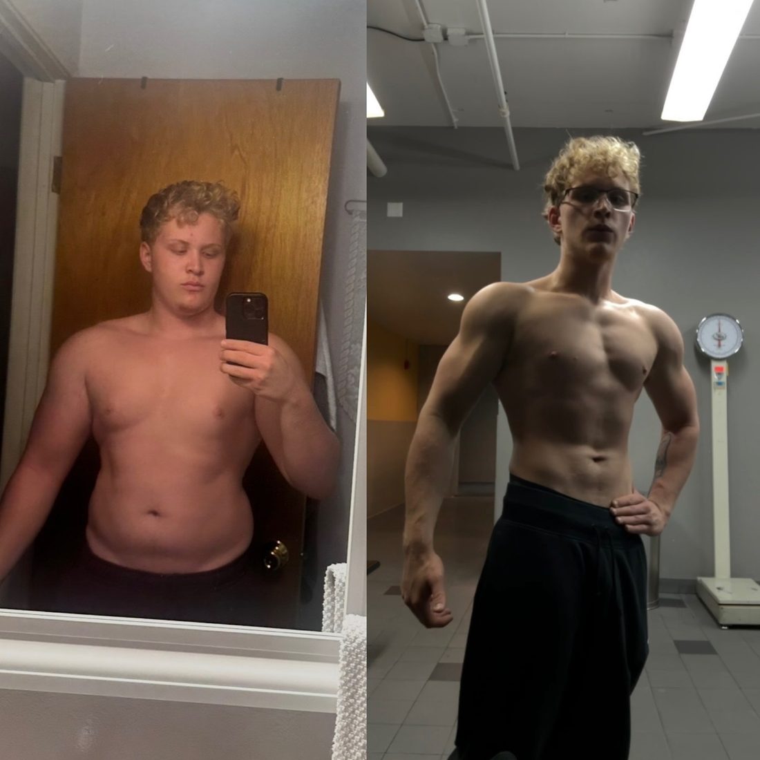Patient before-and-after — front relaxed