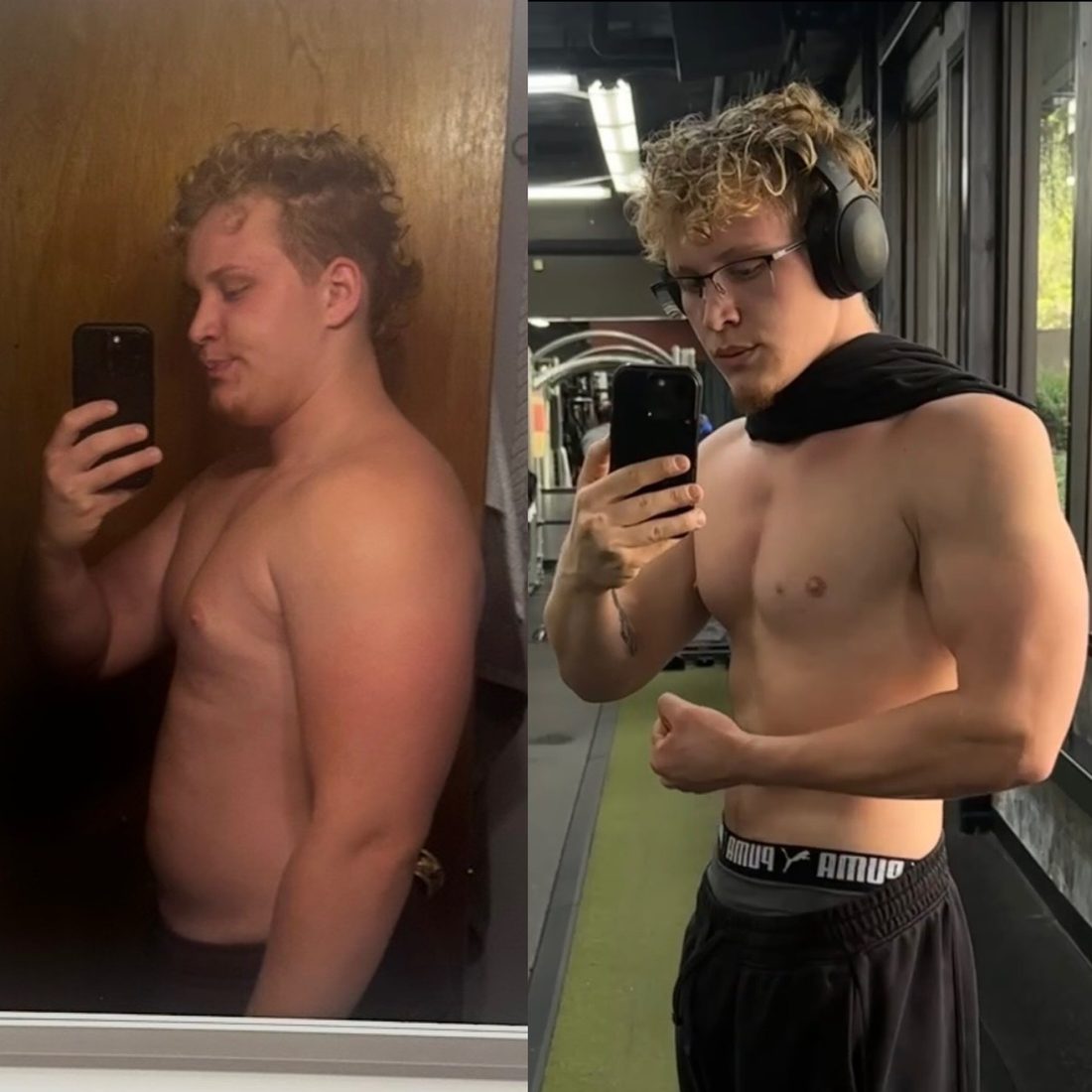 Patient before-and-after — side profile
